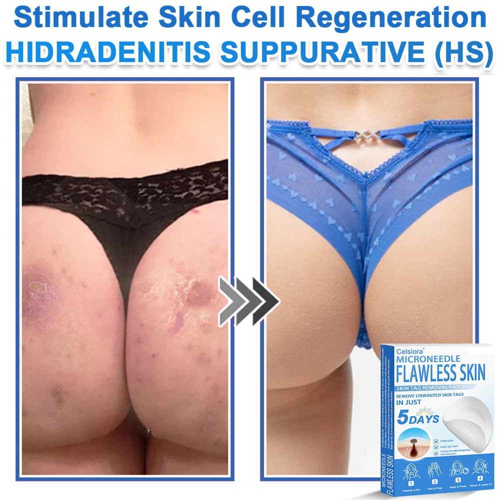 🔥 Neslemy® 2-in-1 Microneedle & Hydrocolloid Patch | Raised Moles,Acne,  Flat Warts & Skin Tags Remover | Improves Wrinkles, Scars & Blemishes | Invisible Pimple Patches for Face & Body