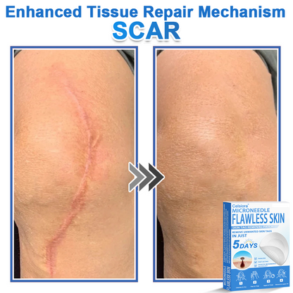 🔥 Neslemy® 2-in-1 Microneedle & Hydrocolloid Patch | Raised Moles,Acne,  Flat Warts & Skin Tags Remover | Improves Wrinkles, Scars & Blemishes | Invisible Pimple Patches for Face & Body