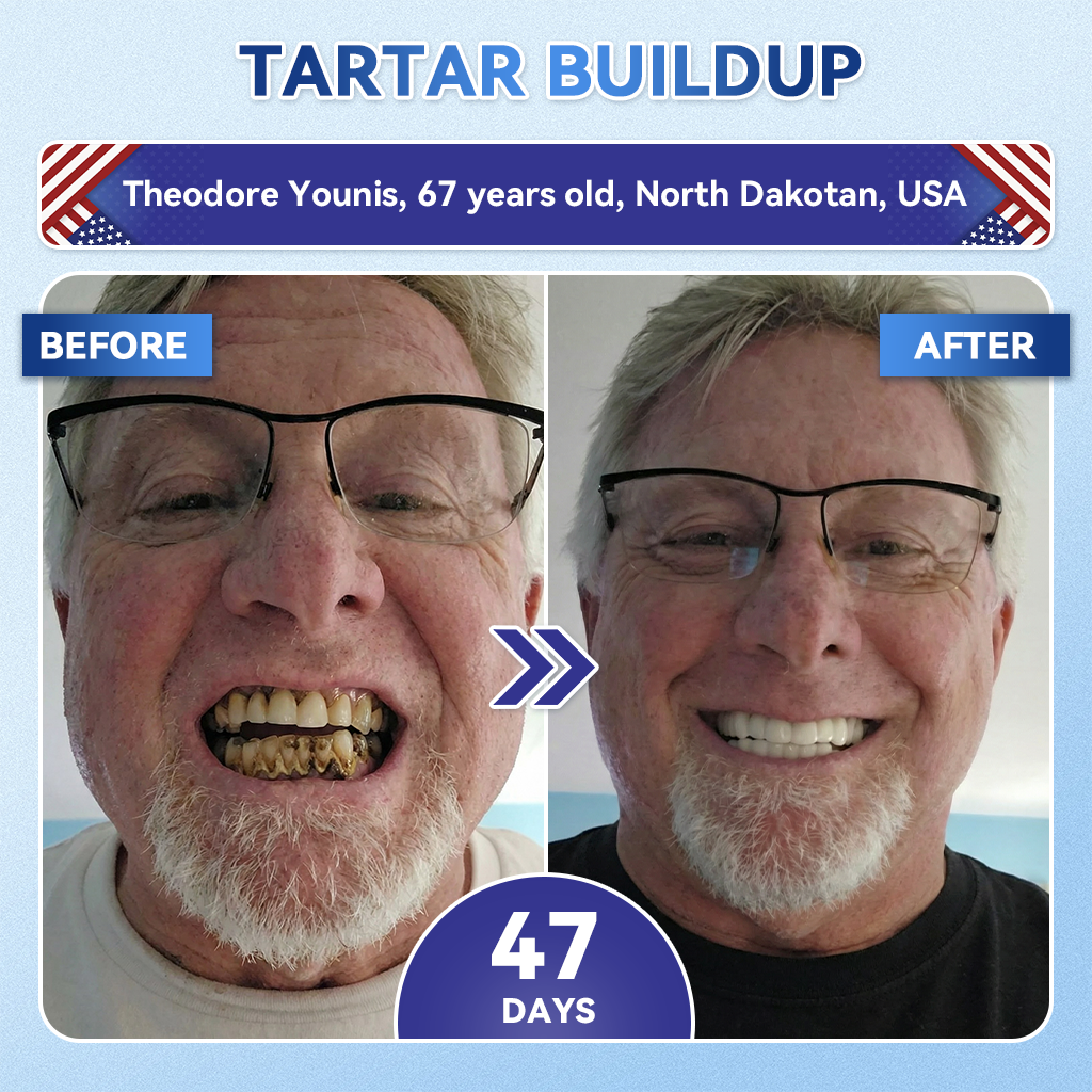 👨‍⚕️𝑶𝒇𝒇𝒊𝒄𝒊𝒂𝒍 𝑺𝒕𝒐𝒓𝒆  | Alisanda®🦷Tideglusib Fast‑Dissolving Tooth & Gum Repair Oral Strips ✨