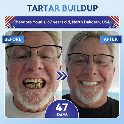 👨‍⚕️𝑶𝒇𝒇𝒊𝒄𝒊𝒂𝒍 𝑺𝒕𝒐𝒓𝒆  | Alisanda®🦷Tideglusib Fast‑Dissolving Tooth & Gum Repair Oral Strips ✨