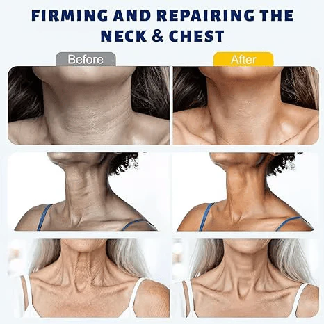 ✨ MISSPONE™ Instant Neck Lift Cream — 🧴 Infused with Retinol & Hyaluronic Acid | Firms the Neck, Reduces Wrinkles & Double Chin