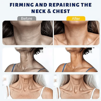 ✨ MISSPONE™ Instant Neck Lift Cream — 🧴 Infused with Retinol & Hyaluronic Acid | Firms the Neck, Reduces Wrinkles & Double Chin