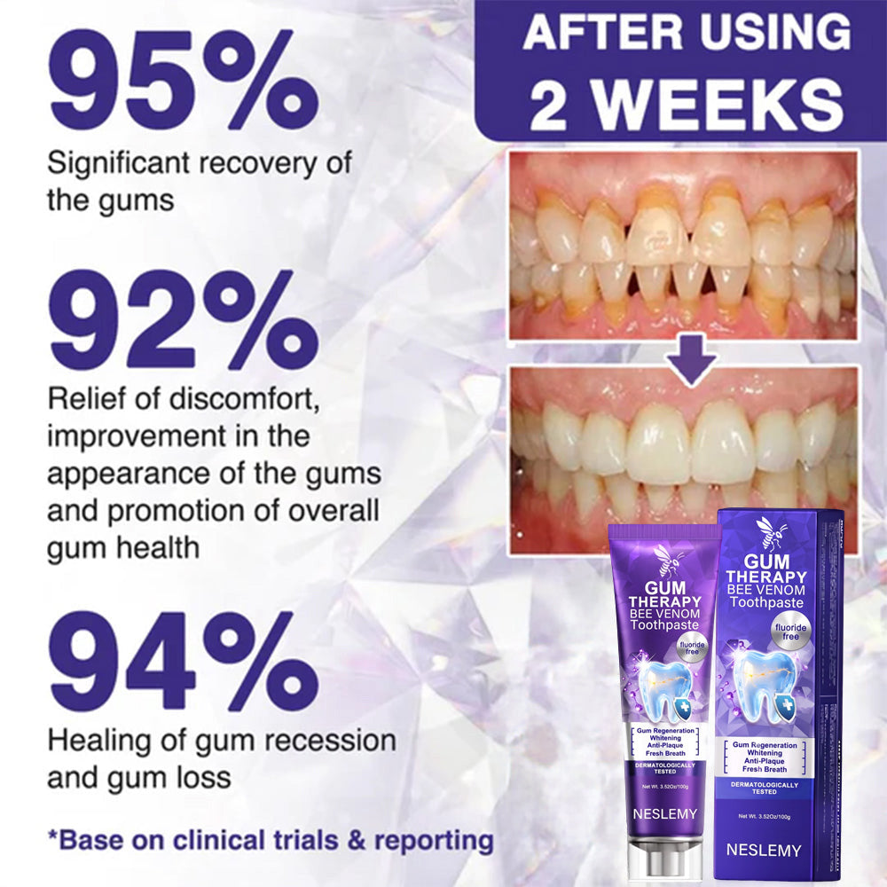 🔥Last Day 80% OFF 👨‍⚕️  NESLEMY® Bee Venom Dental Treatment Toothpaste
