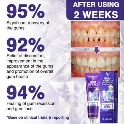 🔥Last Day 80% OFF 👨‍⚕️  NESLEMY® Bee Venom Dental Treatment Toothpaste