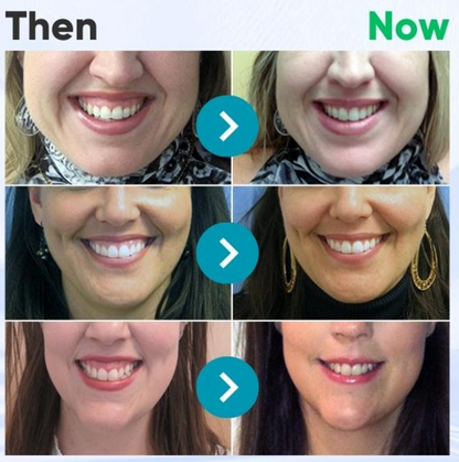 🔥Last Day 80% OFF 👨‍⚕️  NESLEMY® Bee Venom Dental Treatment Toothpaste