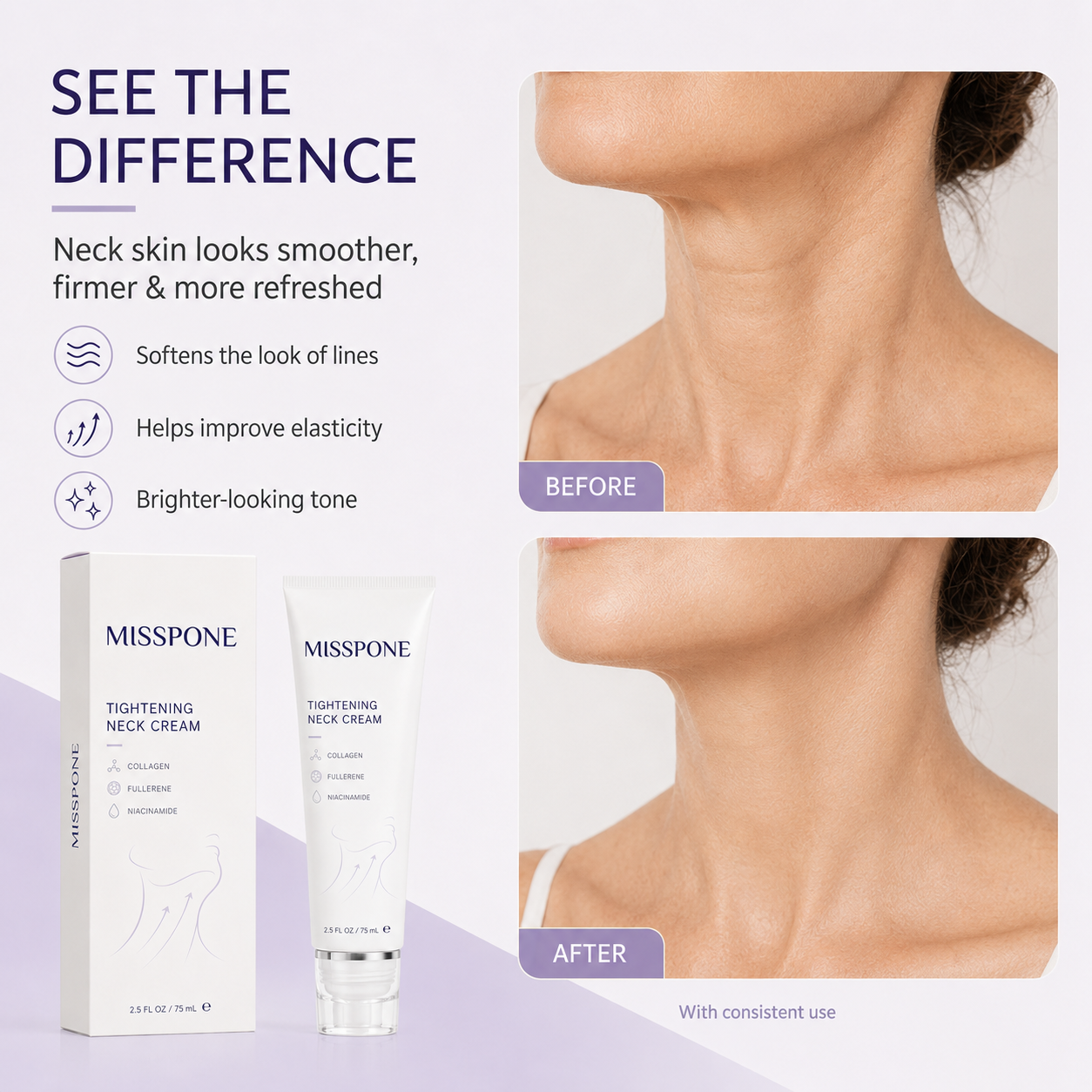 ✨ MISSPONE™ Instant Neck Lift Cream — 🧴 Infused with Retinol & Hyaluronic Acid | Firms the Neck, Reduces Wrinkles & Double Chin